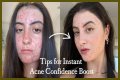 How To Feel Confident With Acne?